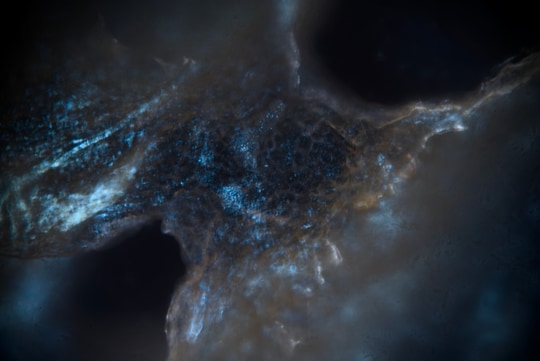A microscope photo of rotting orange peel, processed until it starts to look like a nebula.